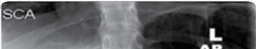 صورة طبية: جراحة العمود الفقري الصدري القطني: دليل شامل للتخطيط والإجراءات العلاجية مع الأستاذ الدكتور محمد هطيف في صنعاء