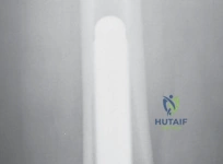 صورة طبية: إتقان موازنة الفجوة في مراجعة استبدال مفصل الركبة: تجنب الأخطاء الشائعة واستعادة الحركة مع الأستاذ الدكتور محمد هطيف
