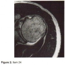 Orthopedic Board Review MCQs: Trauma, Sports Medicine & Pediatrics Part 103