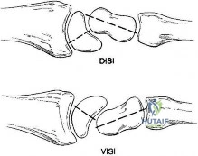 Illustration of skills orthopedic mcqs - Dr. Mohammed Hutaif