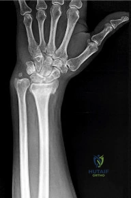 Pediatric Orthopaedic MCQs: Expert Insights et al Reviewed