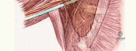 صورة توضيحية لـ استكشاف واستئصال أورام الإبط المعقدة: دليل شامل للمرضى