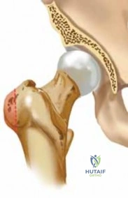 Orthopedic Conditions: Symptoms, Causes and Treatments
