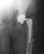 Can You Answer These Sports Med Questions? Orthopedic Quiz