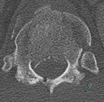 Illustration of risk of major - Dr. Mohammed Hutaif