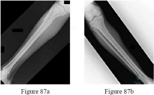 Orthopedic Trauma MCQs: Your Response to Figure-Based Questions
