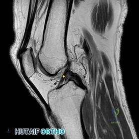 Orthopedic Anatomy Imag Review | Dr Hutaif Basic Scienc -...