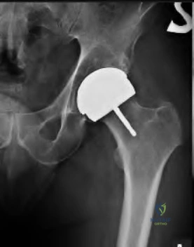 Orthopedic Ob Reconstru Review | Dr Hutaif Hip & Knee R -...