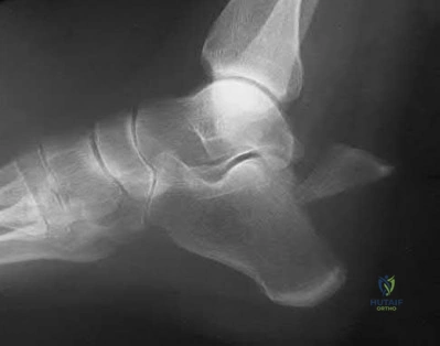 Illustration 92 for OrthoCash: Trauma MCQs & Cases for a yearold woman