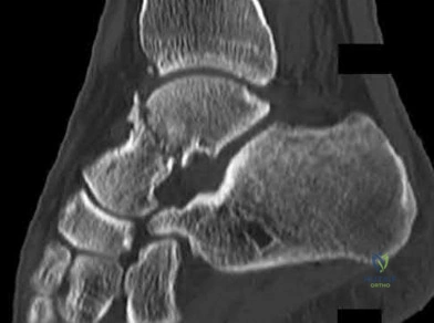 Illustration 120 for OrthoCash: Trauma MCQs & Cases for a yearold woman