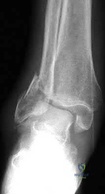 Illustration 29 for OrthoCash: Trauma MCQs & Cases for a yearold woman