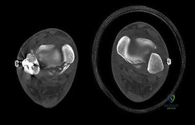 Illustration 54 for OrthoCash: Trauma MCQs & Cases for a yearold woman