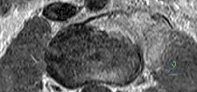 Illustration 20 for OrthoCash: Trauma MCQs & Cases for a yearold woman