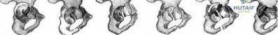 Illustration 13 for OrthoCash: Trauma MCQs & Cases for a yearold woman