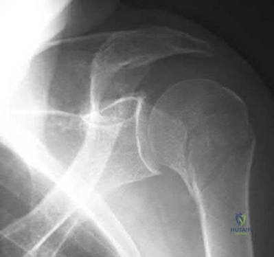 Illustration 87 for OrthoCash: Trauma MCQs & Cases for a yearold woman