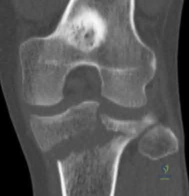 Illustration 41 for OrthoCash: Trauma MCQs & Cases for a yearold woman