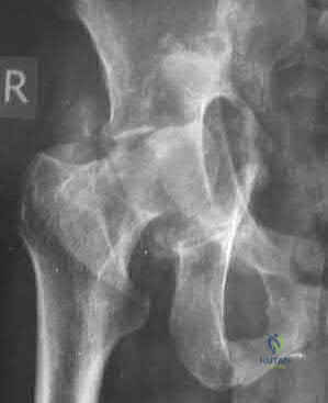 Illustration 60 for OrthoCash: Trauma MCQs & Cases for a yearold woman