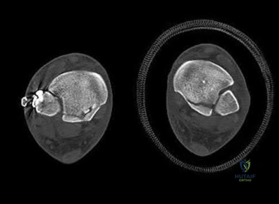 Illustration 53 for OrthoCash: Trauma MCQs & Cases for a yearold woman