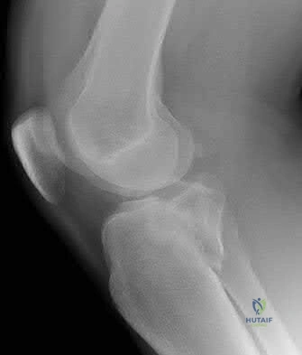 Illustration 39 for OrthoCash: Trauma MCQs & Cases for a yearold woman