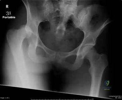 Illustration 88 for OrthoCash: Trauma MCQs & Cases for a yearold woman