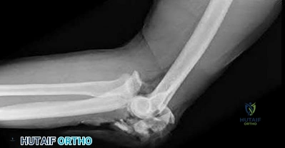 Illustration 117 for OrthoCash: Trauma MCQs & Cases for a yearold woman