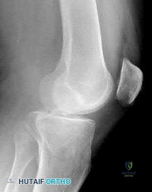 Illustration 25 for OrthoCash: Trauma MCQs & Cases for a yearold woman