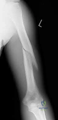 Illustration 78 for OrthoCash: Trauma MCQs & Cases for a yearold woman