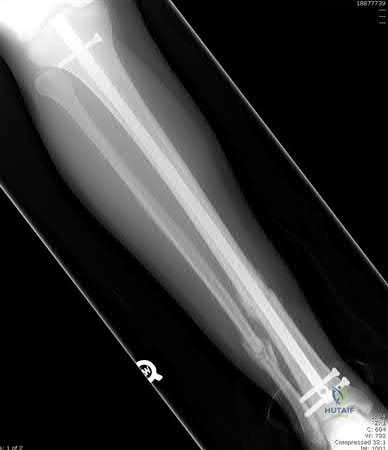 Illustration 2 for OrthoCash: Trauma MCQs & Cases for a yearold woman