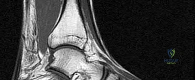 Illustration 104 for OrthoCash: Trauma MCQs & Cases for a yearold woman