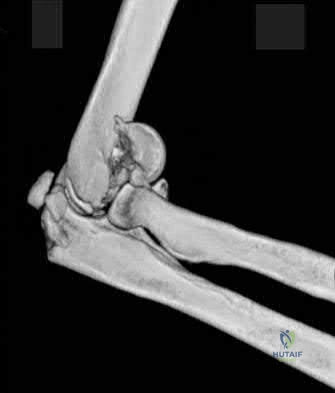 Illustration 34 for OrthoCash: Trauma MCQs & Cases for a yearold woman