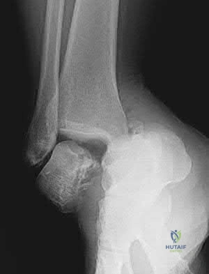 Illustration 5 for OrthoCash: Trauma MCQs & Cases for a yearold woman