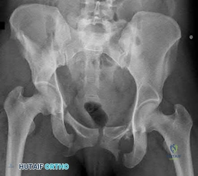 Illustration 177 for OrthoCash: Trauma MCQs & Cases for a yearold woman