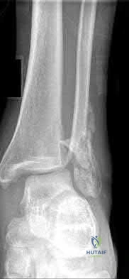 Illustration 93 for OrthoCash: Trauma MCQs & Cases for a yearold woman