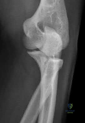 Illustration 37 for OrthoCash: Trauma MCQs & Cases for a yearold woman