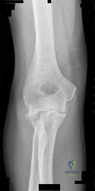 Illustration 77 for OrthoCash: Trauma MCQs & Cases for a yearold woman