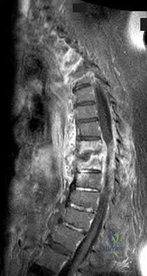 Illustration 11 for OrthoCash: Trauma MCQs & Cases for a yearold woman