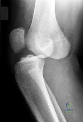 Illustration 68 for OrthoCash: Trauma MCQs & Cases for a yearold woman