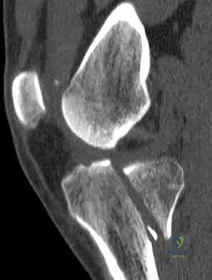 Illustration 42 for OrthoCash: Trauma MCQs & Cases for a yearold woman