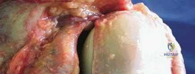 Illustration 80 for OrthoCash: Trauma MCQs & Cases for a yearold woman