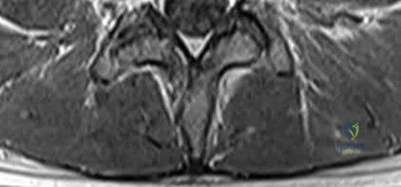 Illustration 21 for OrthoCash: Trauma MCQs & Cases for a yearold woman
