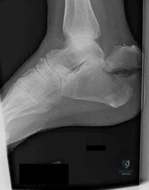 Illustration 208 for OrthoCash: Trauma MCQs & Cases for a yearold woman