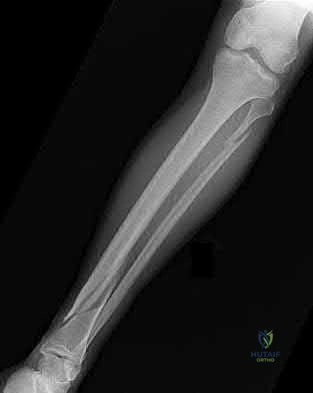 Illustration 194 for OrthoCash: Trauma MCQs & Cases for a yearold woman
