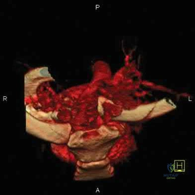 Illustration 47 for OrthoCash: Trauma MCQs & Cases for a yearold woman