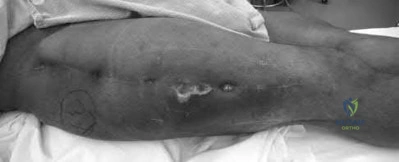 Illustration 201 for OrthoCash: Trauma MCQs & Cases for a yearold woman