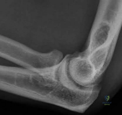 Illustration 36 for OrthoCash: Trauma MCQs & Cases for a yearold woman