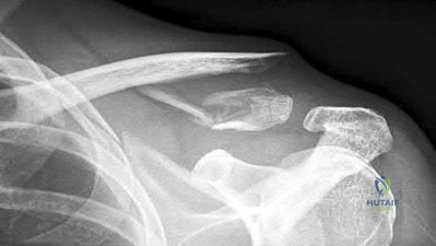 Illustration 86 for OrthoCash: Trauma MCQs & Cases for a yearold woman