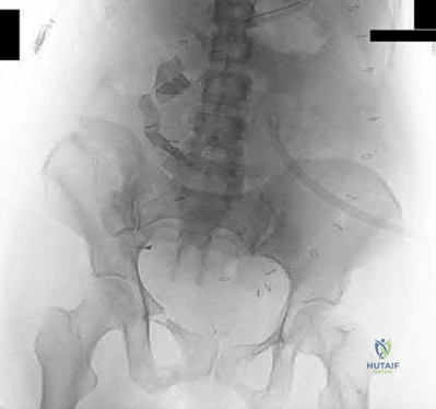 Illustration 198 for OrthoCash: Trauma MCQs & Cases for a yearold woman