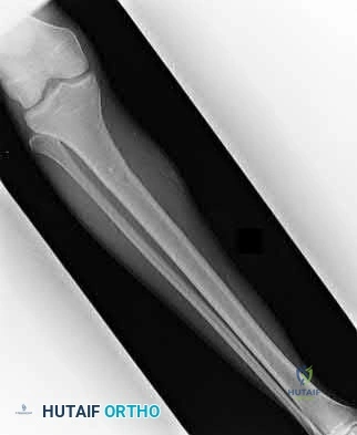 Illustration 205 for OrthoCash: Trauma MCQs & Cases for a yearold woman