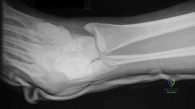 Illustration 98 for OrthoCash: Trauma MCQs & Cases for a yearold woman