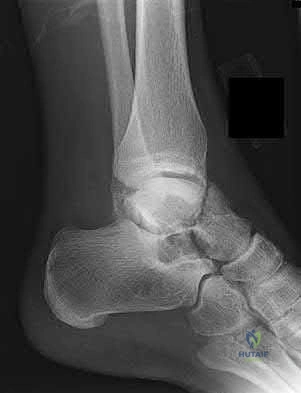 Illustration 119 for OrthoCash: Trauma MCQs & Cases for a yearold woman
